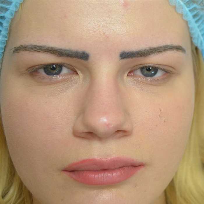 Неправильная форма и размер бровей